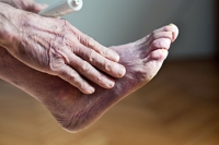 Medical Issues May Lead to Poor Circulation