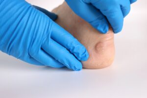 maryland gout institute gout management in owings mills maryland gout institute gout management in owings mills