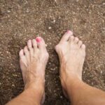 maryland gout institute Gout Treatment in Phoenix