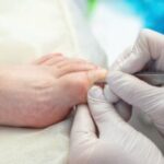 maryland gout institute gout treatment in columbia